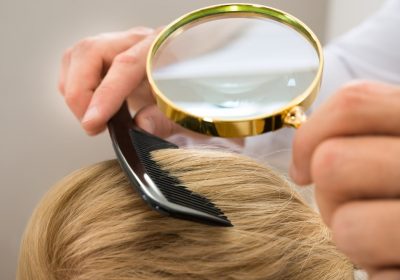 This Week’s Top Stories About Head Lice